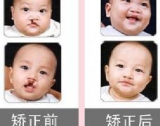 吃兔肉真的會長兔唇？為什么會長兔唇？